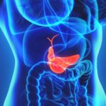 Foods That Cause Gallbladder Problems – Gallbladder diet