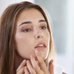 Why Should You Consult A Skin Specialist For Acne Treatment?