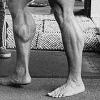 Arnold’s Calf Input
